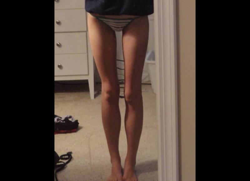 Худые ноги у девушки ( 42 фото )
