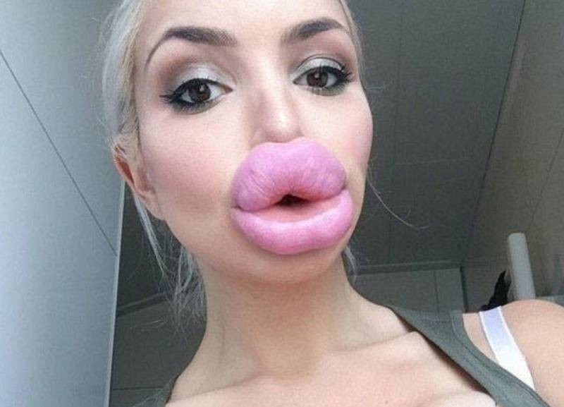 Девушки с перекаченными губами