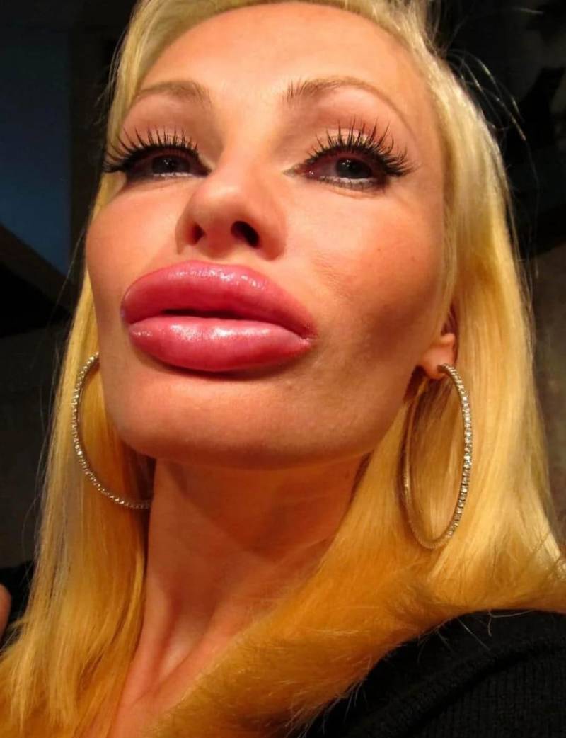 Перекаченные губы бантиком