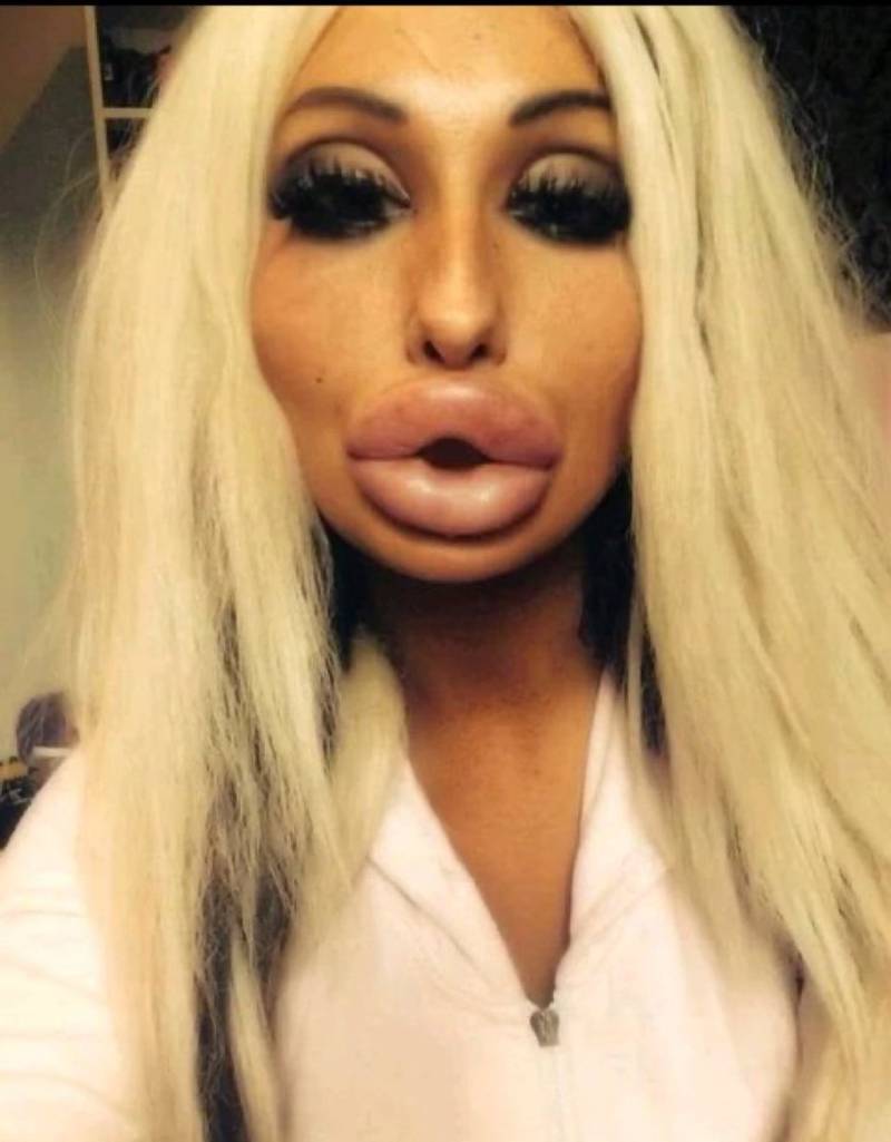 Блондинка с накаченными губами